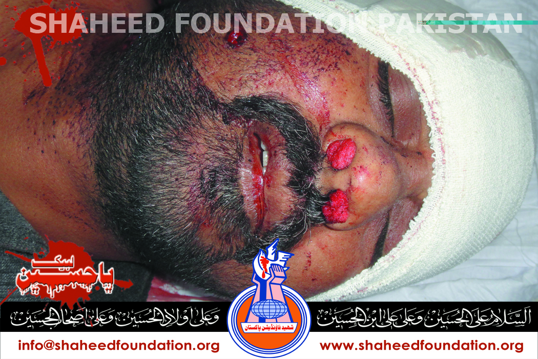 Shaheed Afzal Naqvi Shaheed Afzal Naqvi