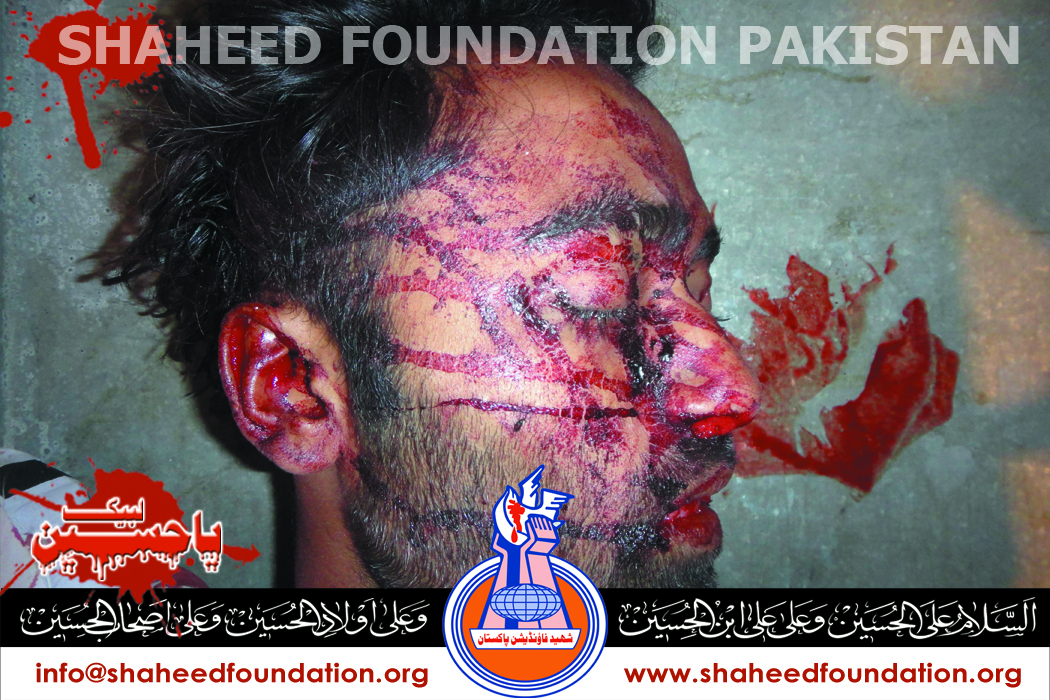 Shaheed Ali Hasnain Shaheed Ali Hasnain