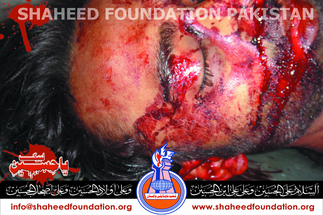 Shaheed Ali Hasnain Shaheed Ali Hasnain