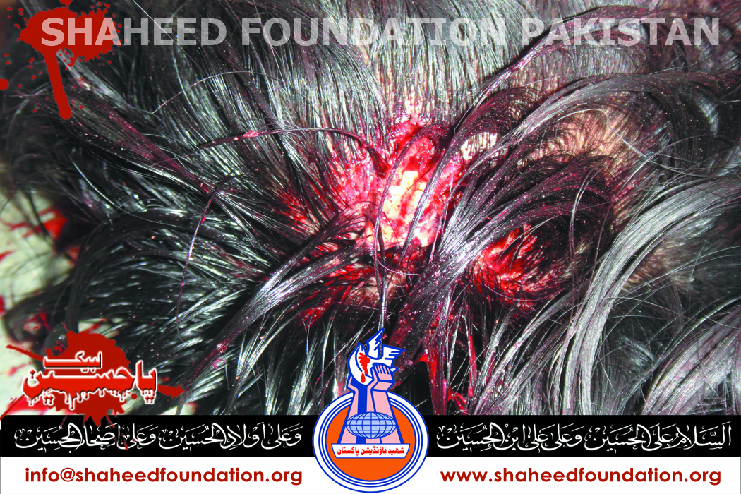 Shaheed Ali Hayder Shaheed Ali Hayder