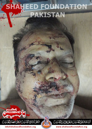 shaheed Shaban Ali shaheed Shaban Ali