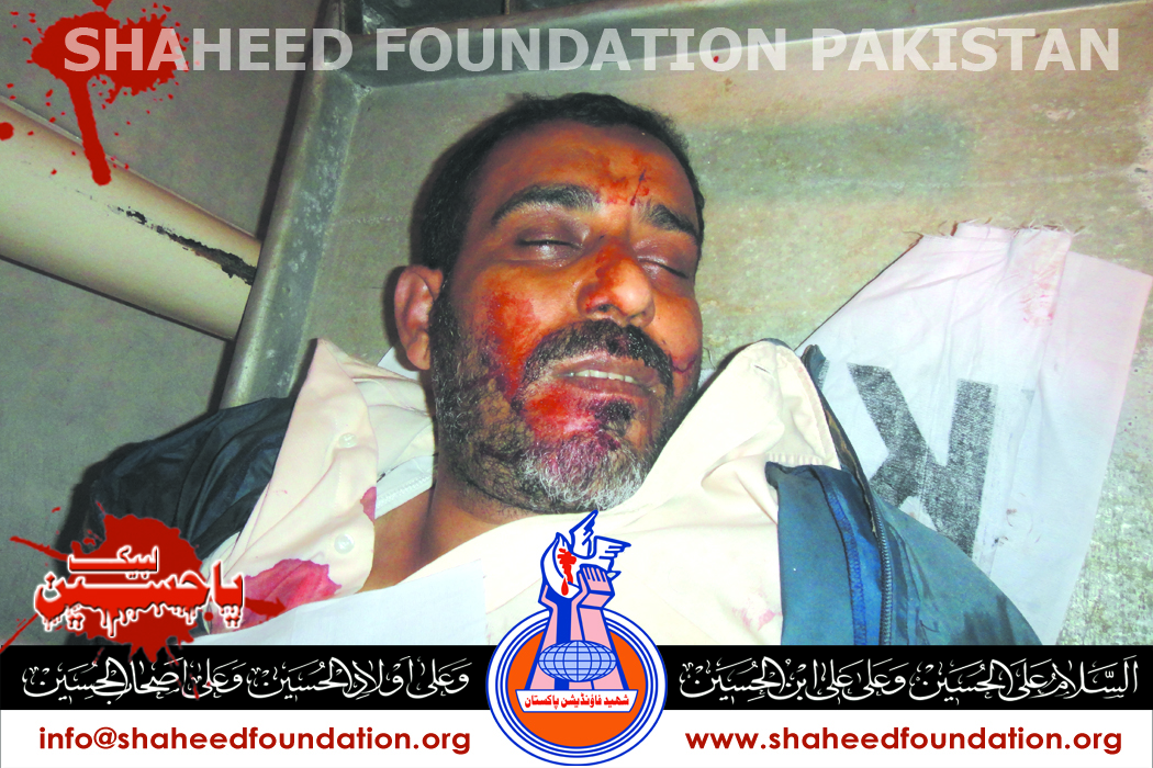Shaheed Imran Hussain Shaheed Imran Hussain